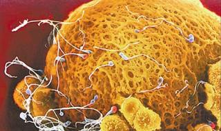 正常褐色分泌物图片 正常褐色分泌物图片